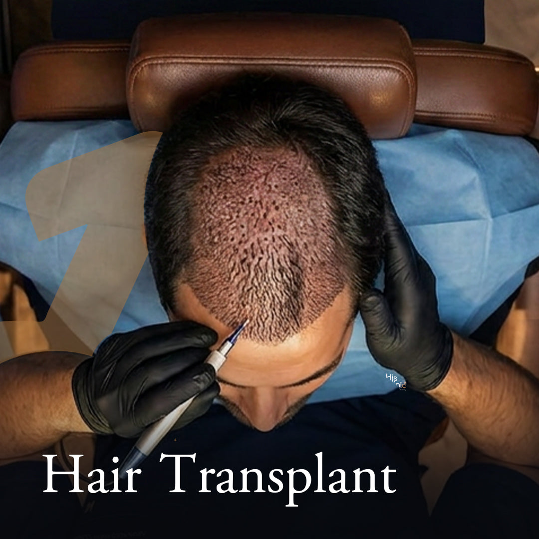 Hair Transplant