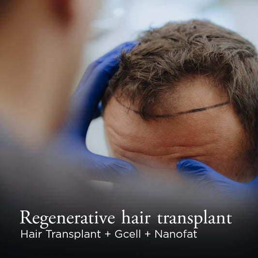 Regenerative Hair Transplant ( Hair Transplant +Gcell + Nanofat )